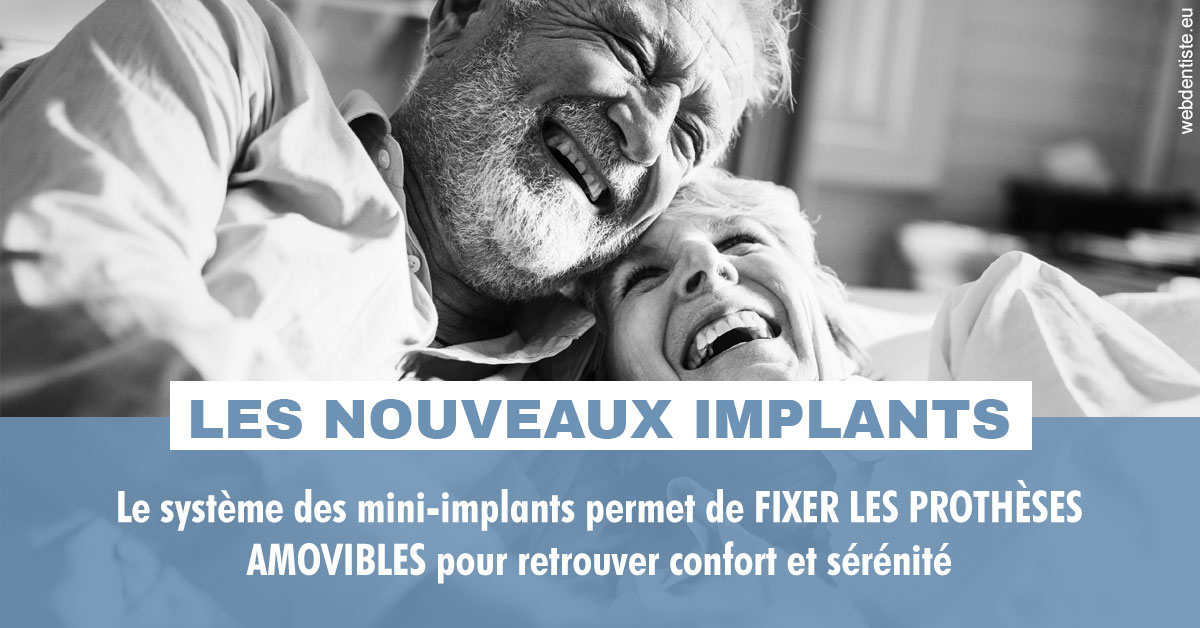 https://dr-levy-charles.chirurgiens-dentistes.fr/Les nouveaux implants 2