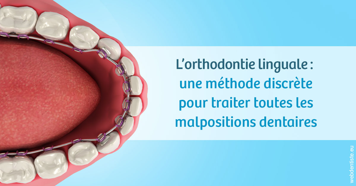 https://dr-levy-charles.chirurgiens-dentistes.fr/L'orthodontie linguale 1