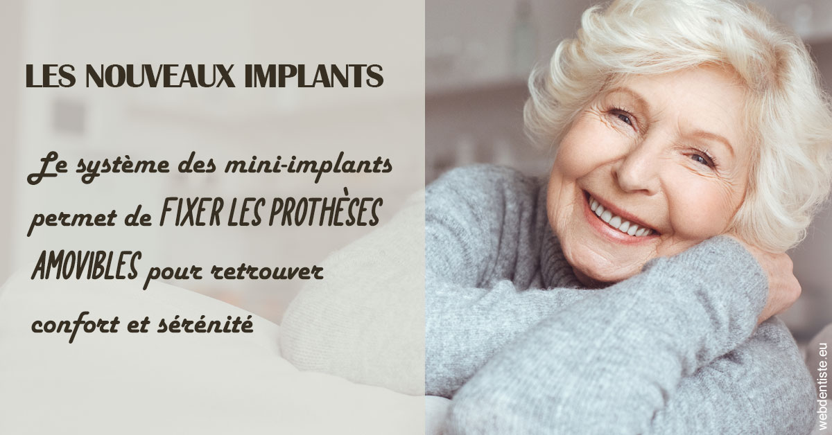 https://dr-levy-charles.chirurgiens-dentistes.fr/Les nouveaux implants 1