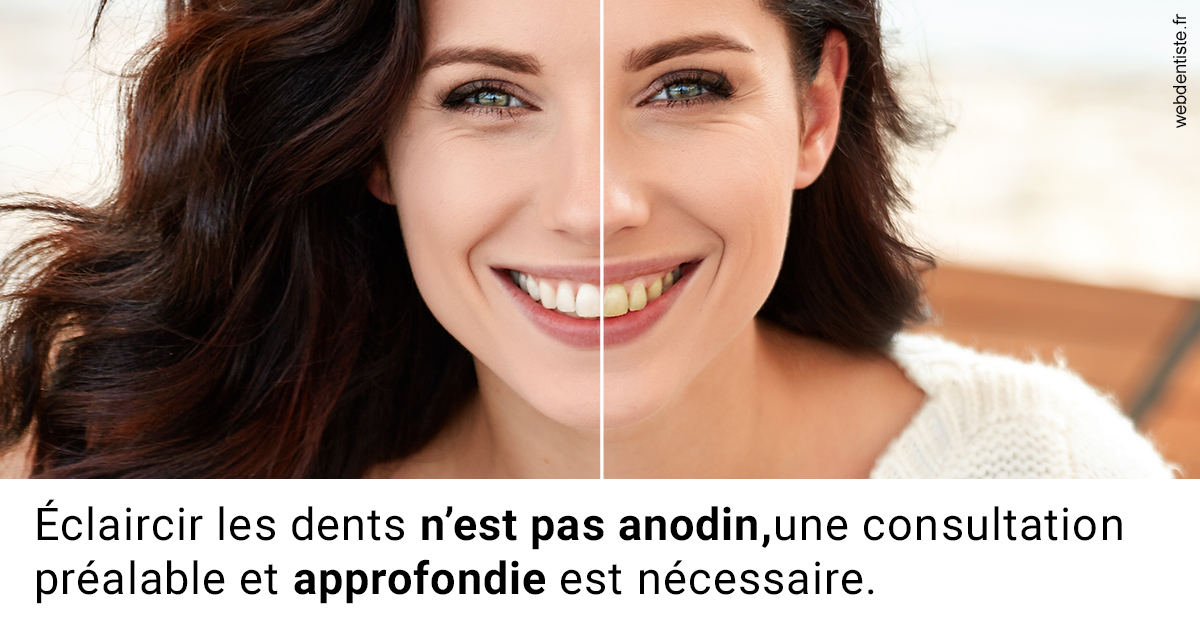 https://dr-levy-charles.chirurgiens-dentistes.fr/Le blanchiment 2