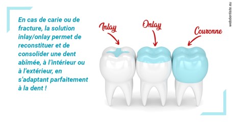 https://dr-levy-charles.chirurgiens-dentistes.fr/L'INLAY ou l'ONLAY