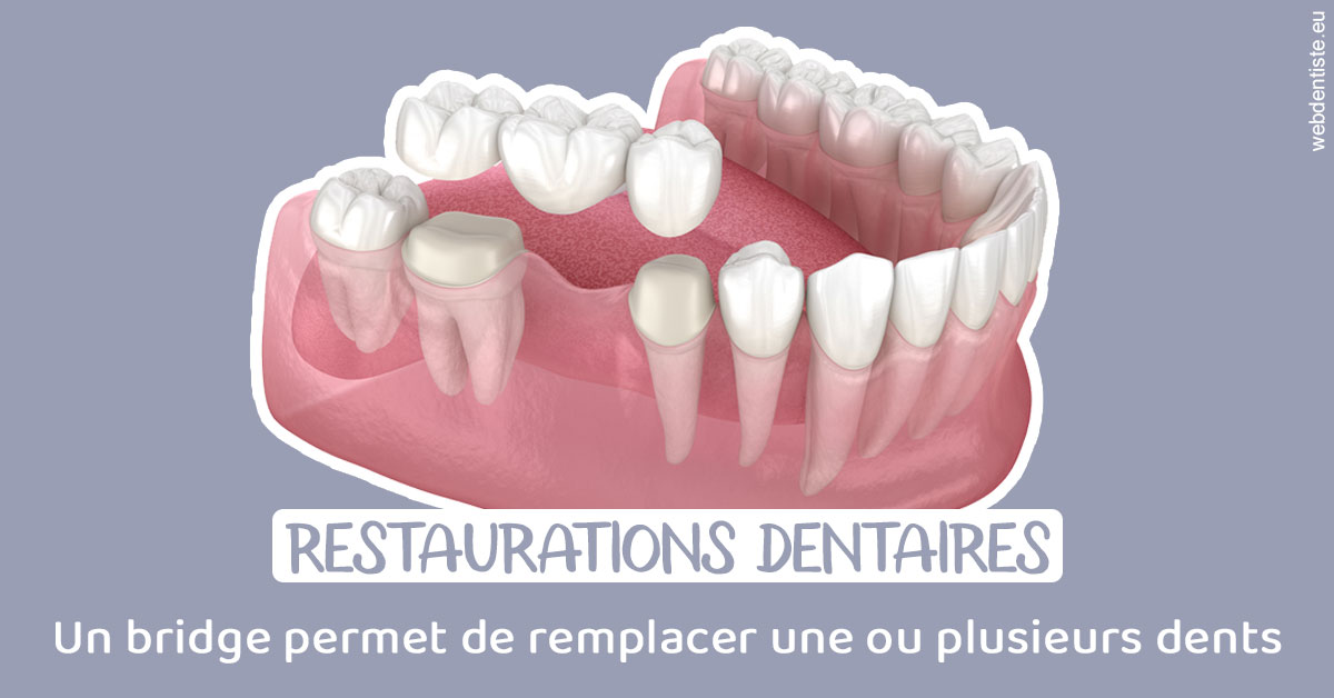 https://dr-levy-charles.chirurgiens-dentistes.fr/Bridge remplacer dents 1