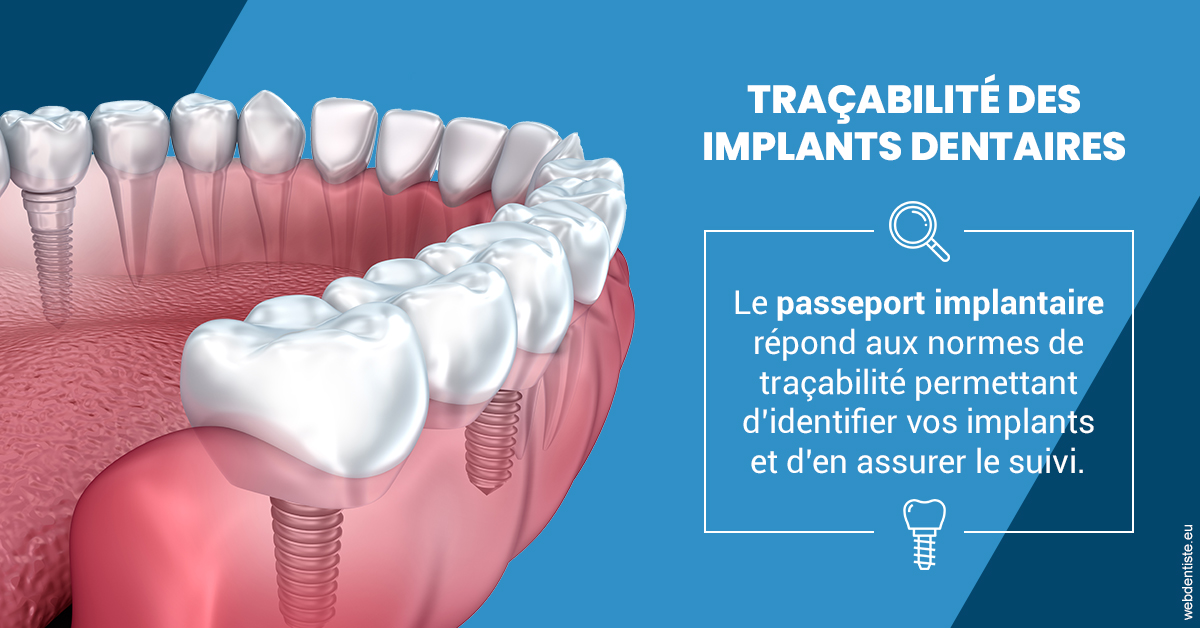 https://dr-levy-charles.chirurgiens-dentistes.fr/T2 2023 - Traçabilité des implants 1