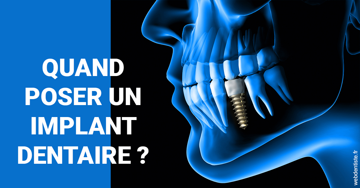 https://dr-levy-charles.chirurgiens-dentistes.fr/Les implants 1