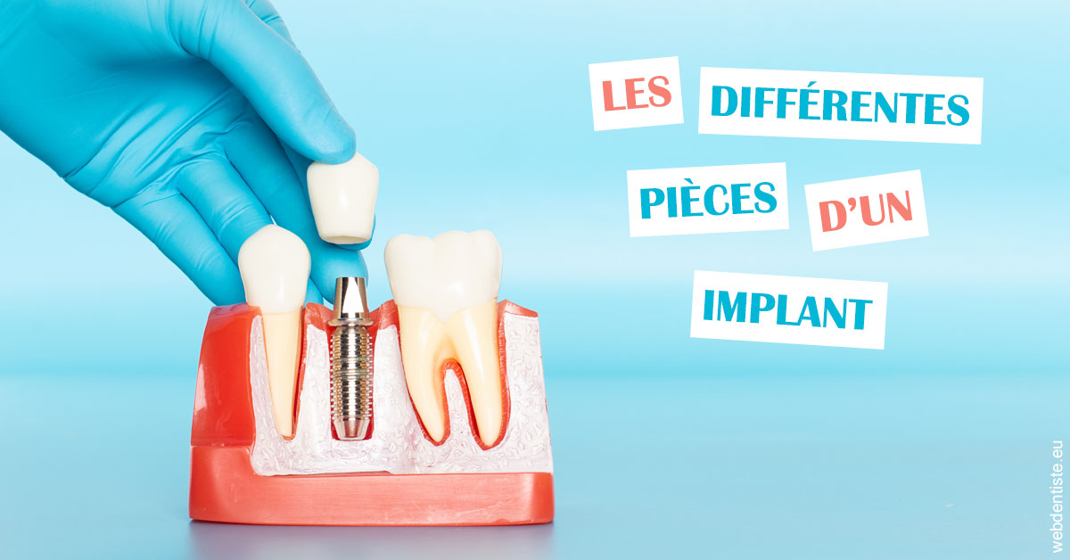 https://dr-levy-charles.chirurgiens-dentistes.fr/Les différentes pièces d’un implant 2