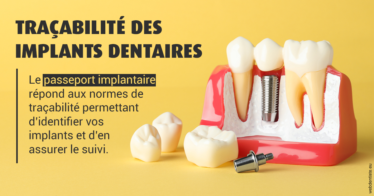 https://dr-levy-charles.chirurgiens-dentistes.fr/T2 2023 - Traçabilité des implants 2