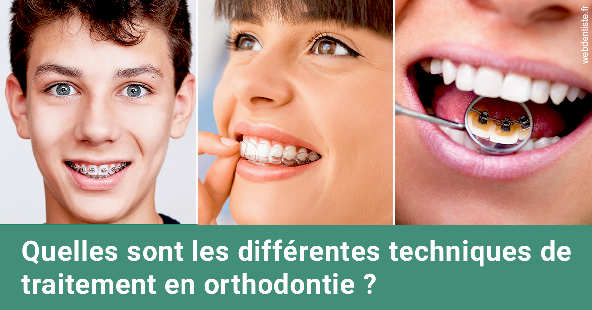 https://dr-levy-charles.chirurgiens-dentistes.fr/Les différentes techniques de traitement 2