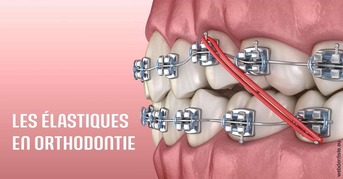 https://dr-levy-charles.chirurgiens-dentistes.fr/Elastiques orthodontie 2