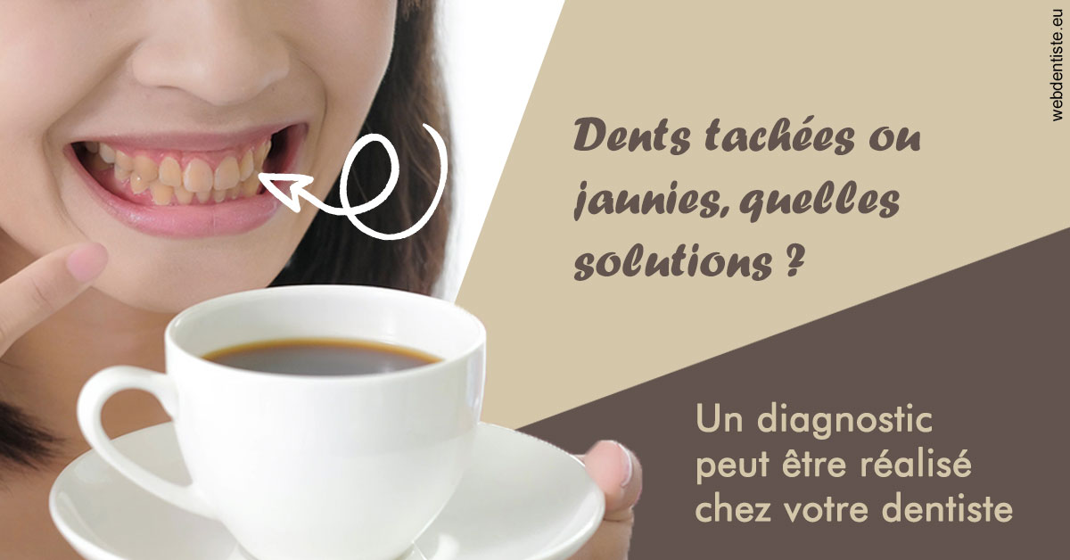 https://dr-levy-charles.chirurgiens-dentistes.fr/Dents tachées 1