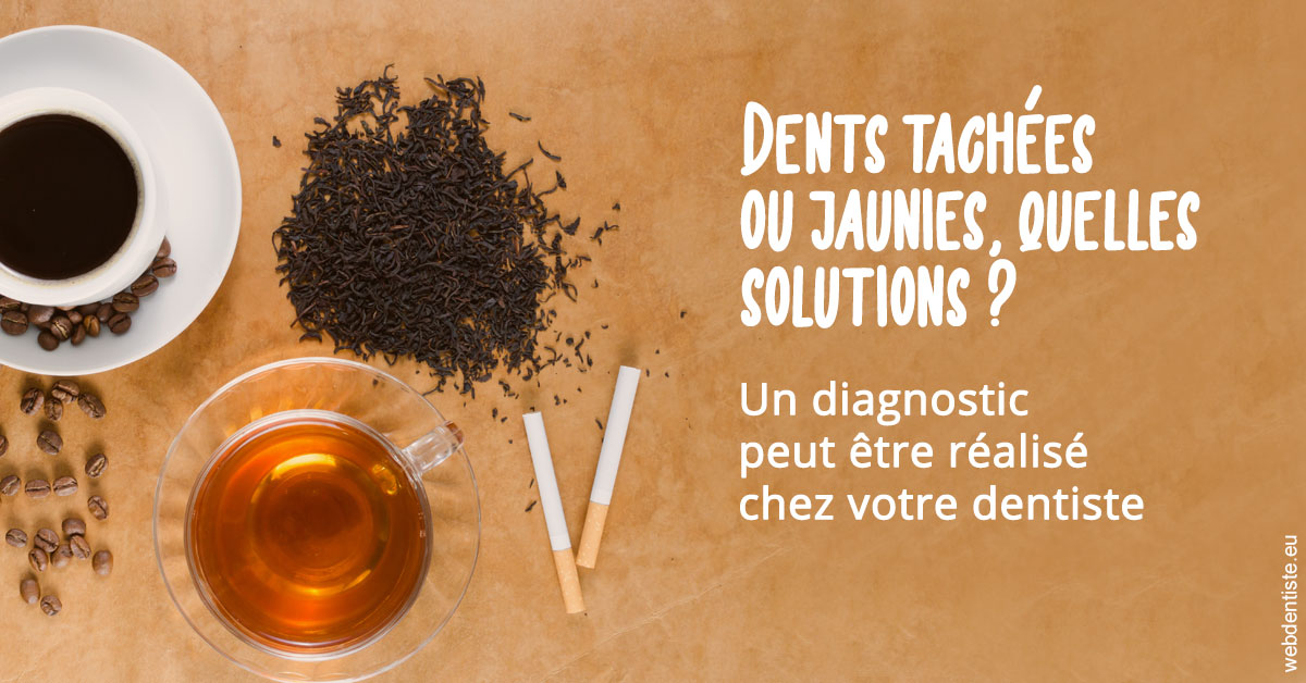https://dr-levy-charles.chirurgiens-dentistes.fr/Dents tachées 2