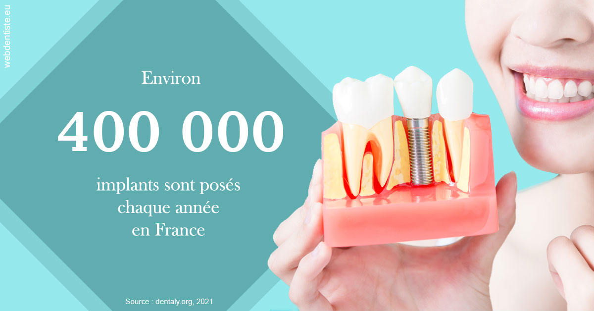 https://dr-levy-charles.chirurgiens-dentistes.fr/Pose d'implants en France 2