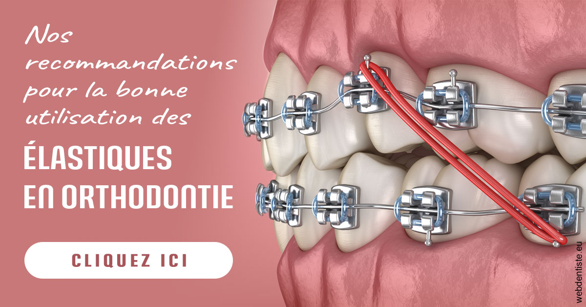 https://dr-levy-charles.chirurgiens-dentistes.fr/Elastiques orthodontie 2